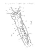 SUTURE LOCK diagram and image