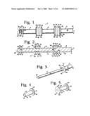 Dynamic stabilization connecting member with pre-tensioned solid core diagram and image