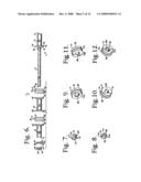 Dynamic stabilization connecting member with pre-tensioned solid core diagram and image