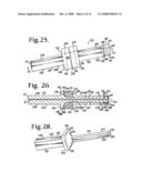 Dynamic stabilization connecting member with pre-tensioned solid core diagram and image