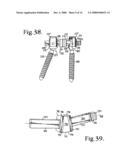 Dynamic stabilization connecting member with pre-tensioned solid core diagram and image