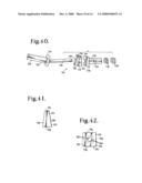 Dynamic stabilization connecting member with pre-tensioned solid core diagram and image