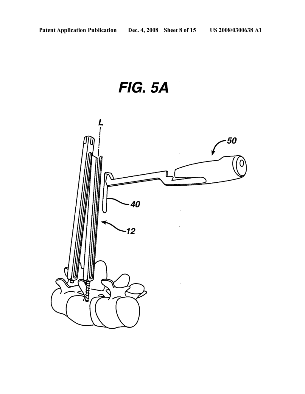 BREAK-OFF SCREW EXTENSIONS - diagram, schematic, and image 09