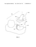 Method for manipulating a dental virtual model, method for creating physical entities based on a dental virtual model thus manipulated, and dental models thus created diagram and image