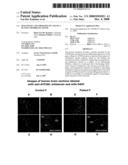 Diagnostic and Therapeutic use of a Plasma Membrane Atpase diagram and image