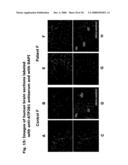 Diagnostic and Therapeutic use of a Plasma Membrane Atpase diagram and image