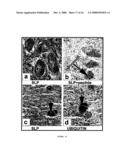 Parkin interacting polypeptides and methods of use diagram and image