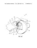 CUTTING GUIDE SYSTEM AND METHOD diagram and image