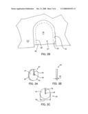 CUTTING GUIDE SYSTEM AND METHOD diagram and image