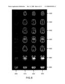 System and Method for Performing Single Photon Emission Computed Tomography (Spect) with a Focal-Length Cone-Beam Collimation diagram and image