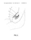 Positioning structure for luminous device diagram and image