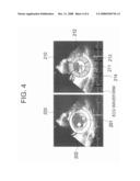 ULTRASONIC IMAGE PROCESSING APPARATUS AND METHOD FOR PROCESSING ULTRASONIC IMAGE diagram and image