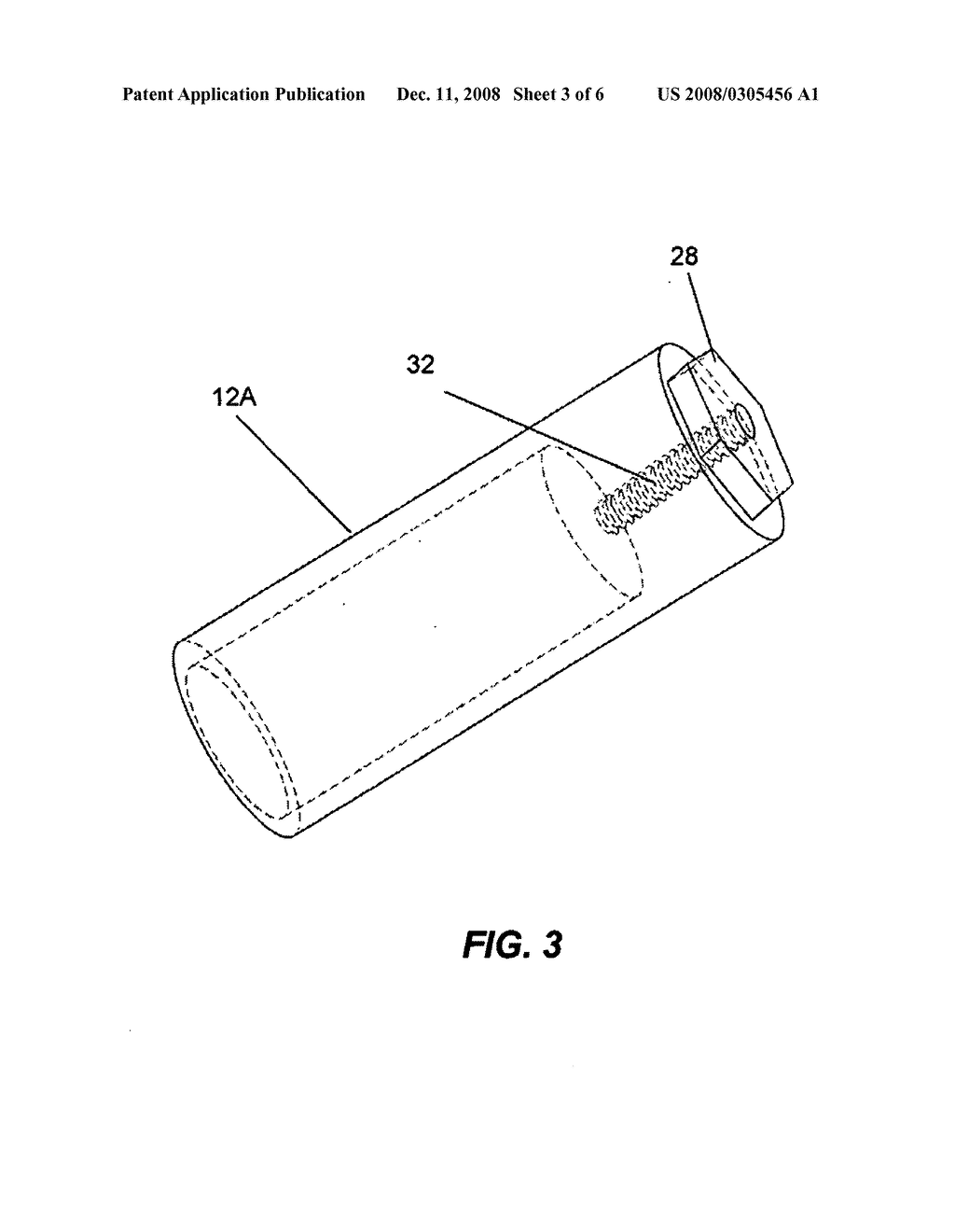 Dental implant stabilizing device - diagram, schematic, and image 04