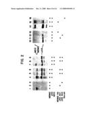 AMPLIFICATION OF HUMAN MDM2 GENE IN HUMAN TUMORS diagram and image