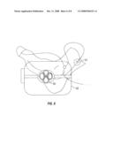 METHOD AND APPARATUS FOR MAGNETIC INDUCTION THERAPY diagram and image