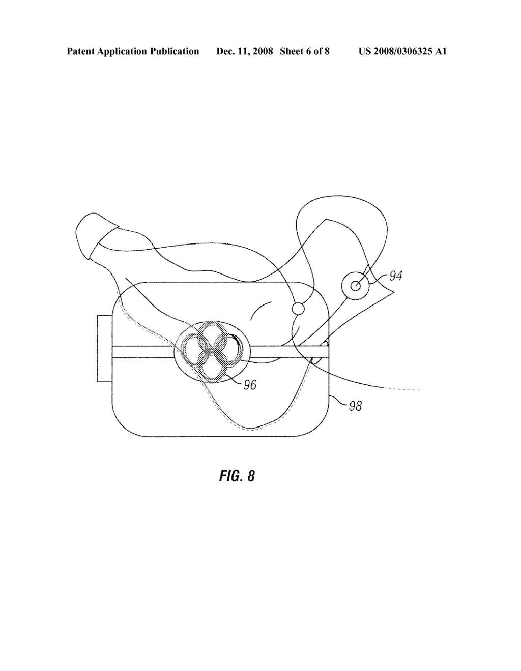 METHOD AND APPARATUS FOR MAGNETIC INDUCTION THERAPY - diagram, schematic, and image 07