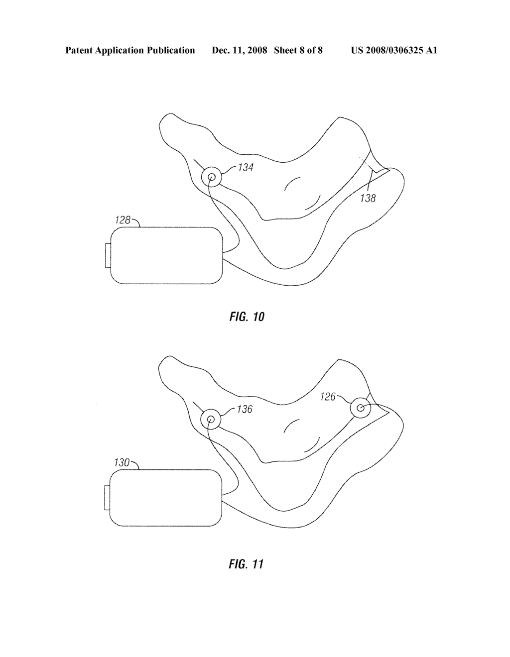 METHOD AND APPARATUS FOR MAGNETIC INDUCTION THERAPY - diagram, schematic, and image 09