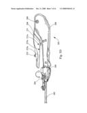 Surgical device diagram and image