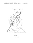 Surgical device diagram and image