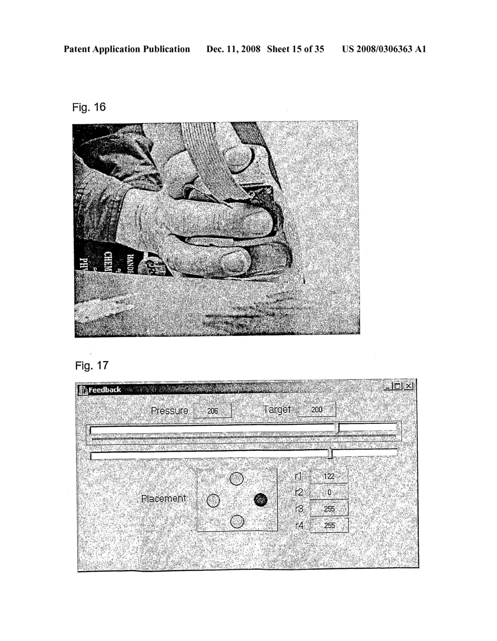 Specialized Human Servo Device And Process For Tissue Modulation Of Human Fingerprints - diagram, schematic, and image 16