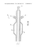 MARKERS FOR INTERVENTIONAL DEVICES IN MAGNETIC RESONANT IMAGE (MRI) SYSTEMS diagram and image