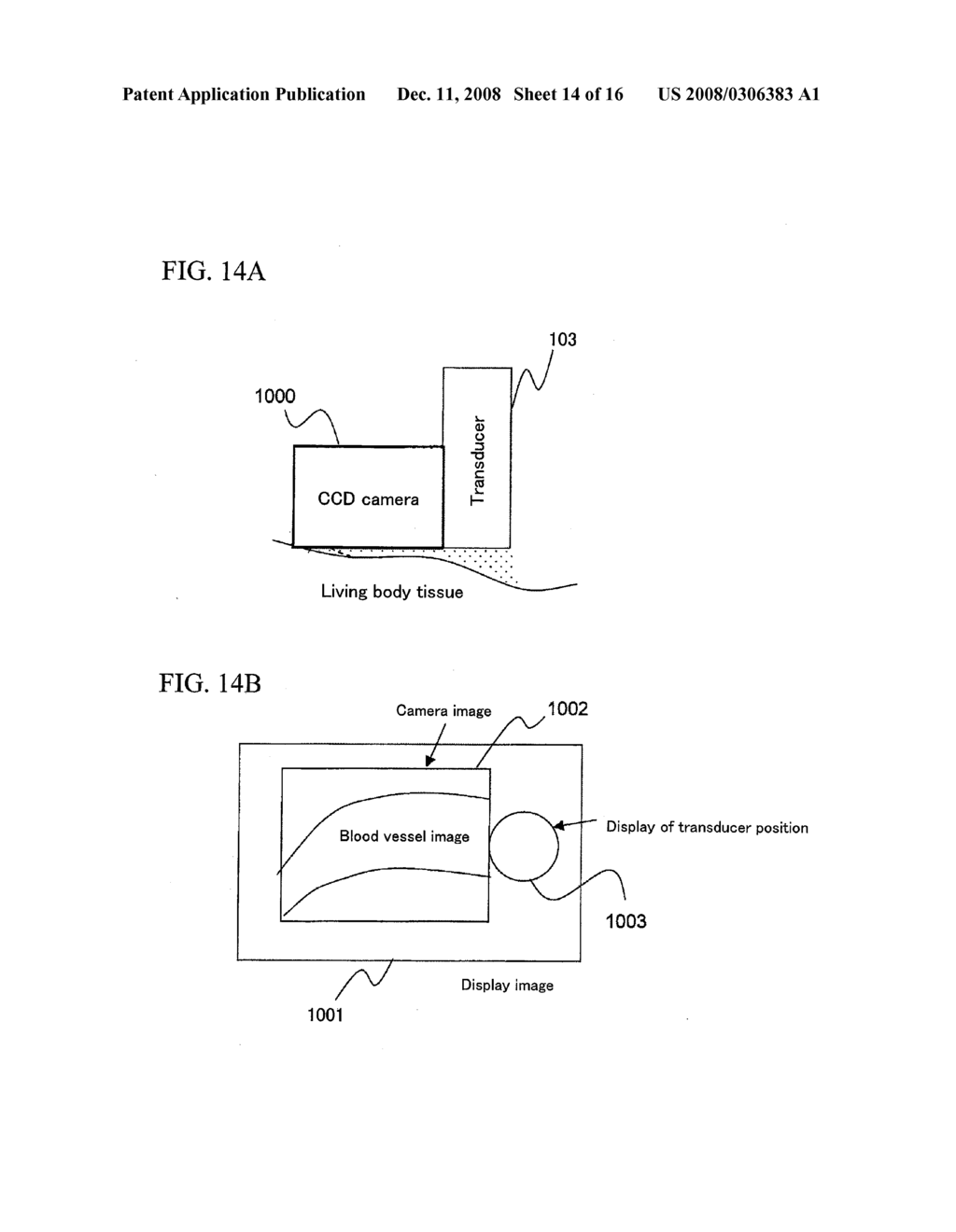 BLOOD FLOW MEASURING AND EVALUATING APPARATUS - diagram, schematic, and image 15