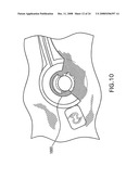 Apparatuses and Methods For Electrophysiological Signal Delivery and Recording During Mri diagram and image