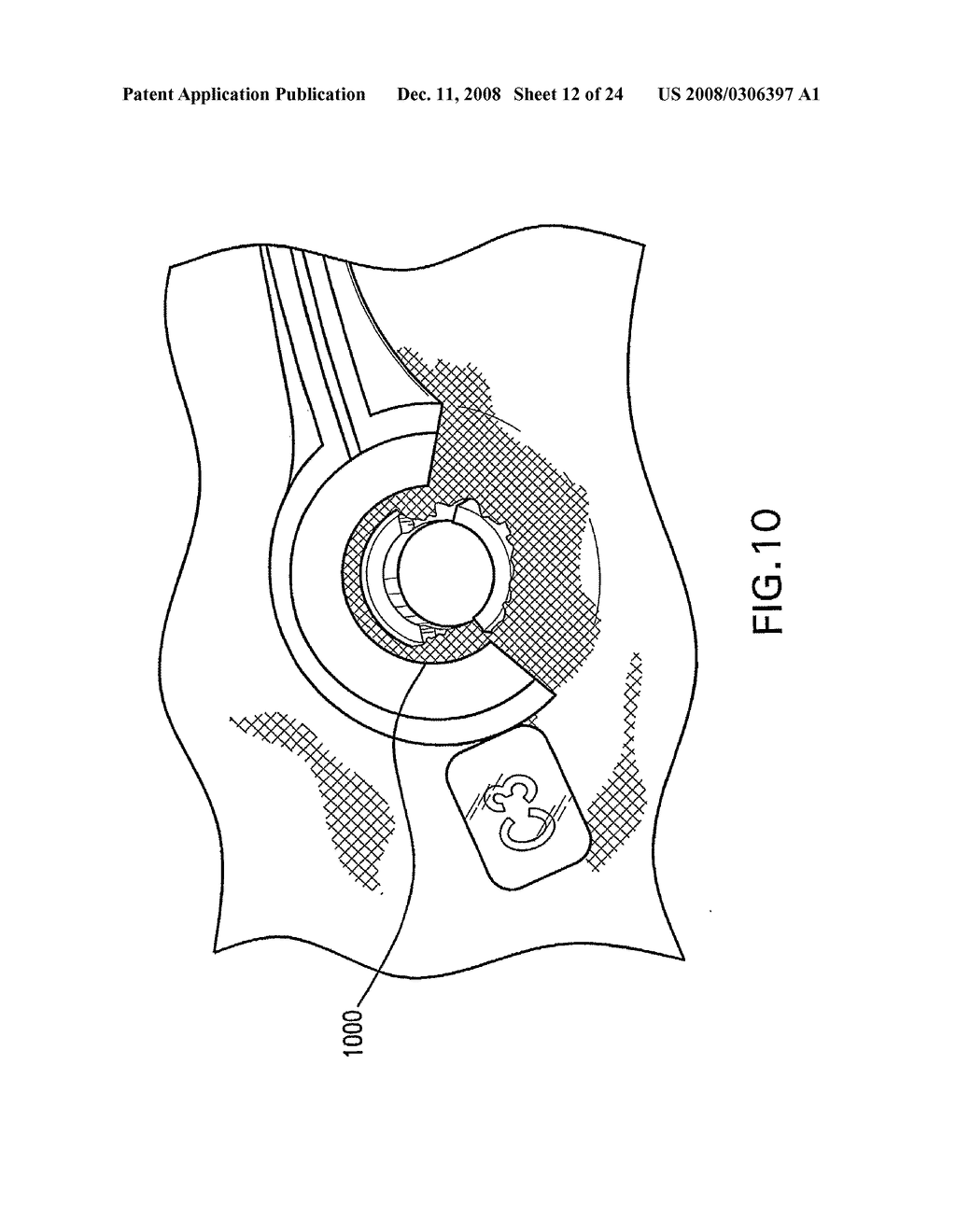 Apparatuses and Methods For Electrophysiological Signal Delivery and Recording During Mri - diagram, schematic, and image 13