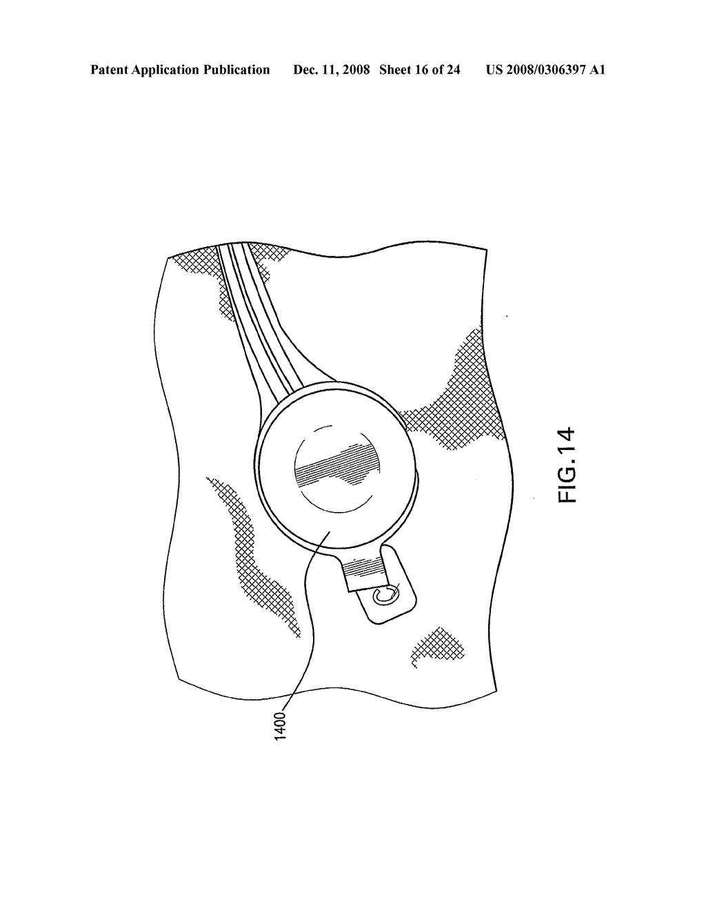 Apparatuses and Methods For Electrophysiological Signal Delivery and Recording During Mri - diagram, schematic, and image 17