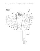 COMPRESSION DEVICE WITH INDEPENDENTLY MOVEABLE INFLATABLE MEMBER diagram and image