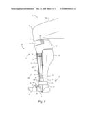 ANCHORED ANKLE SUPPORT diagram and image