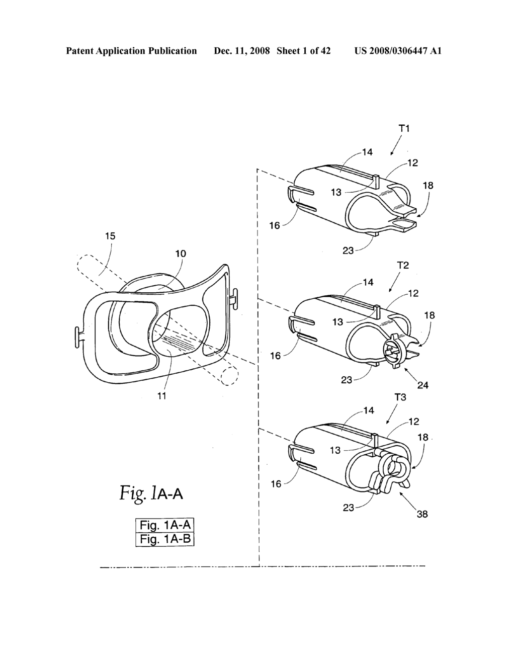 Systems and methods employing a bite block insert for positioning and stabilizing external instruments deployed within the body - diagram, schematic, and image 02