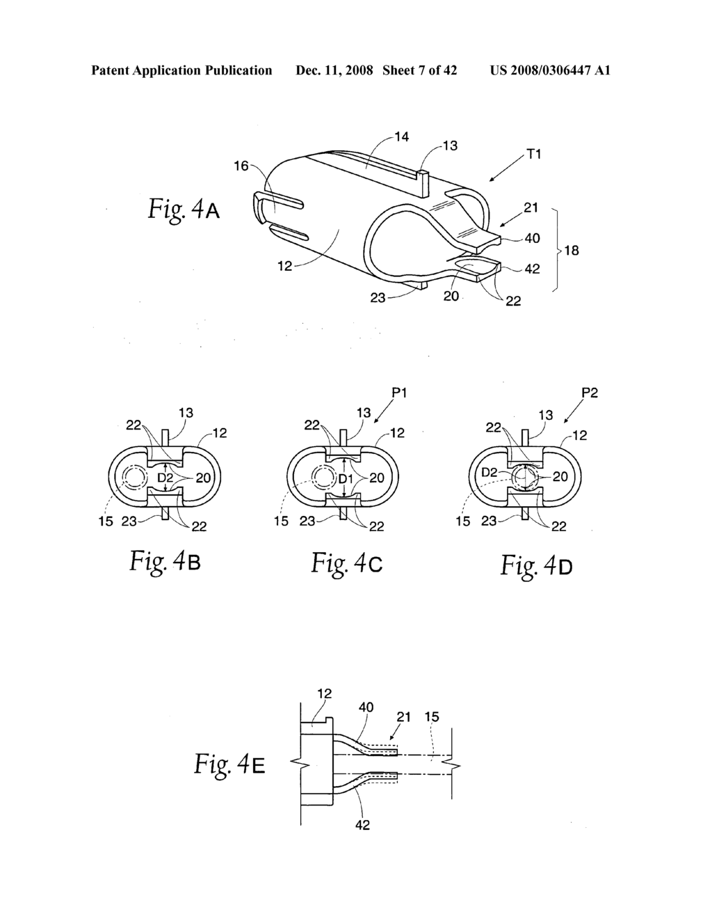 Systems and methods employing a bite block insert for positioning and stabilizing external instruments deployed within the body - diagram, schematic, and image 08