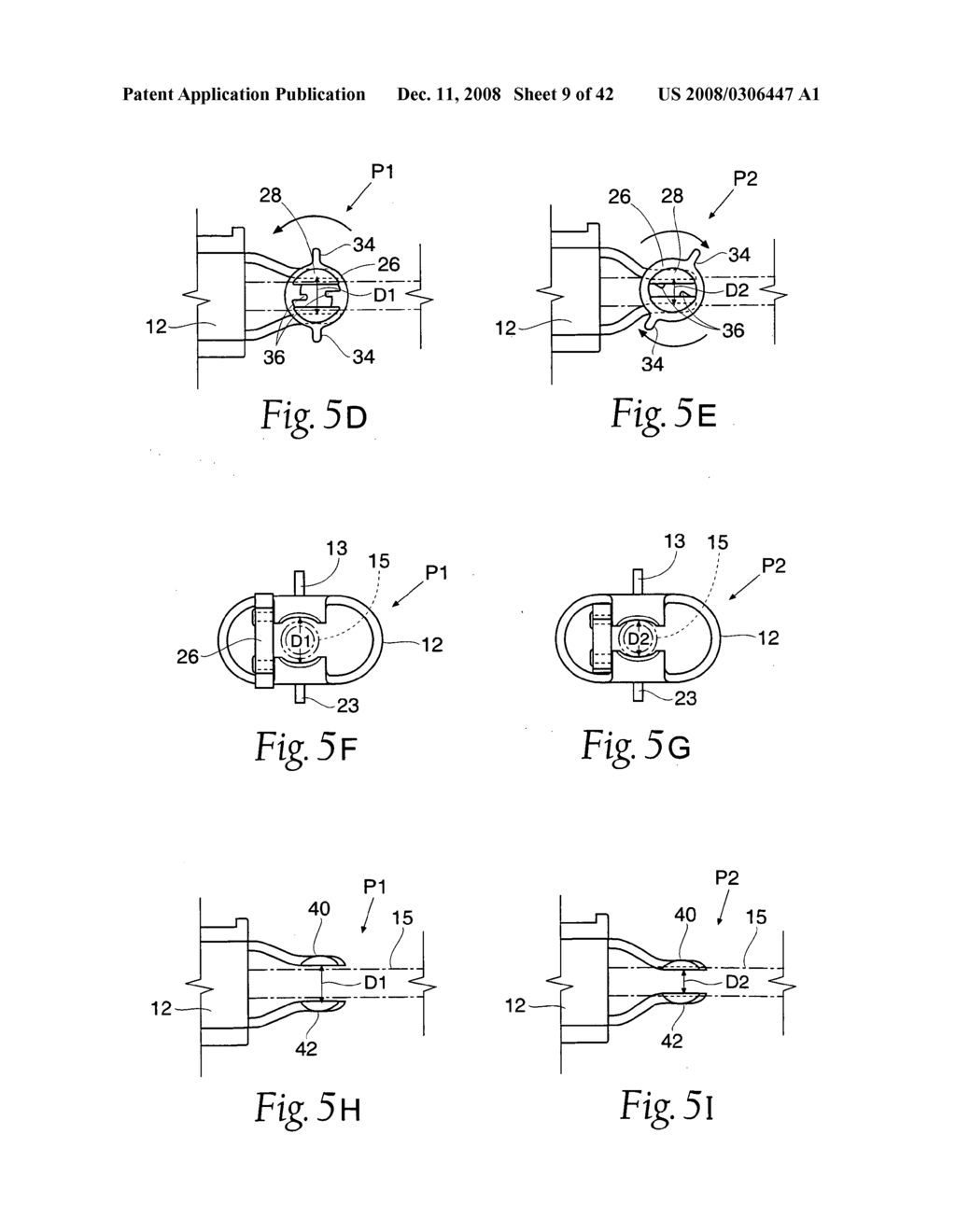 Systems and methods employing a bite block insert for positioning and stabilizing external instruments deployed within the body - diagram, schematic, and image 10