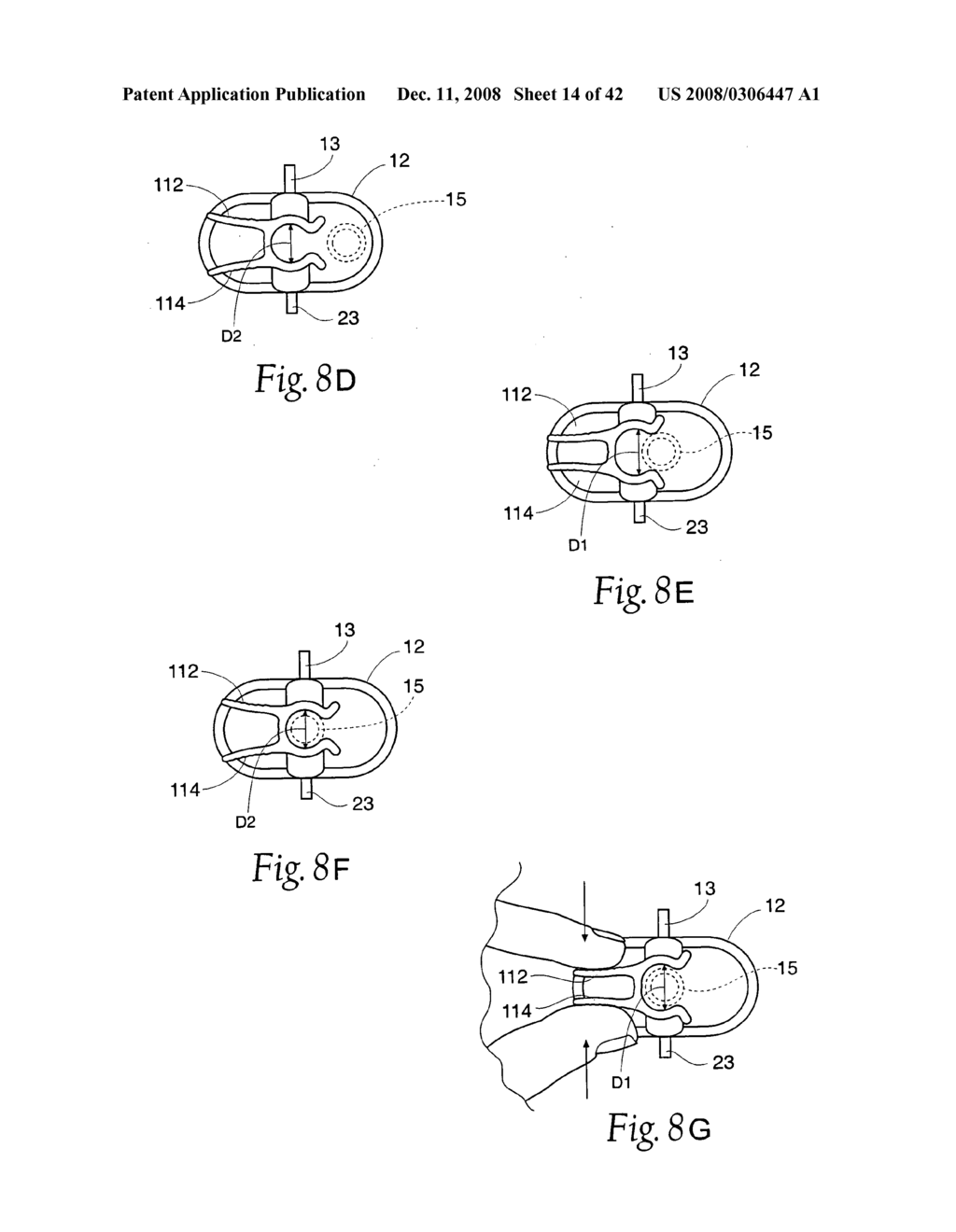 Systems and methods employing a bite block insert for positioning and stabilizing external instruments deployed within the body - diagram, schematic, and image 15