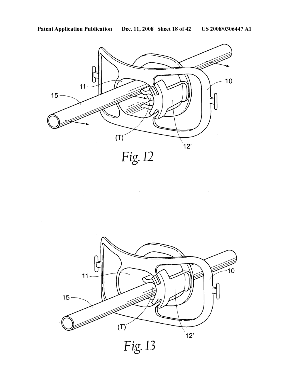 Systems and methods employing a bite block insert for positioning and stabilizing external instruments deployed within the body - diagram, schematic, and image 19