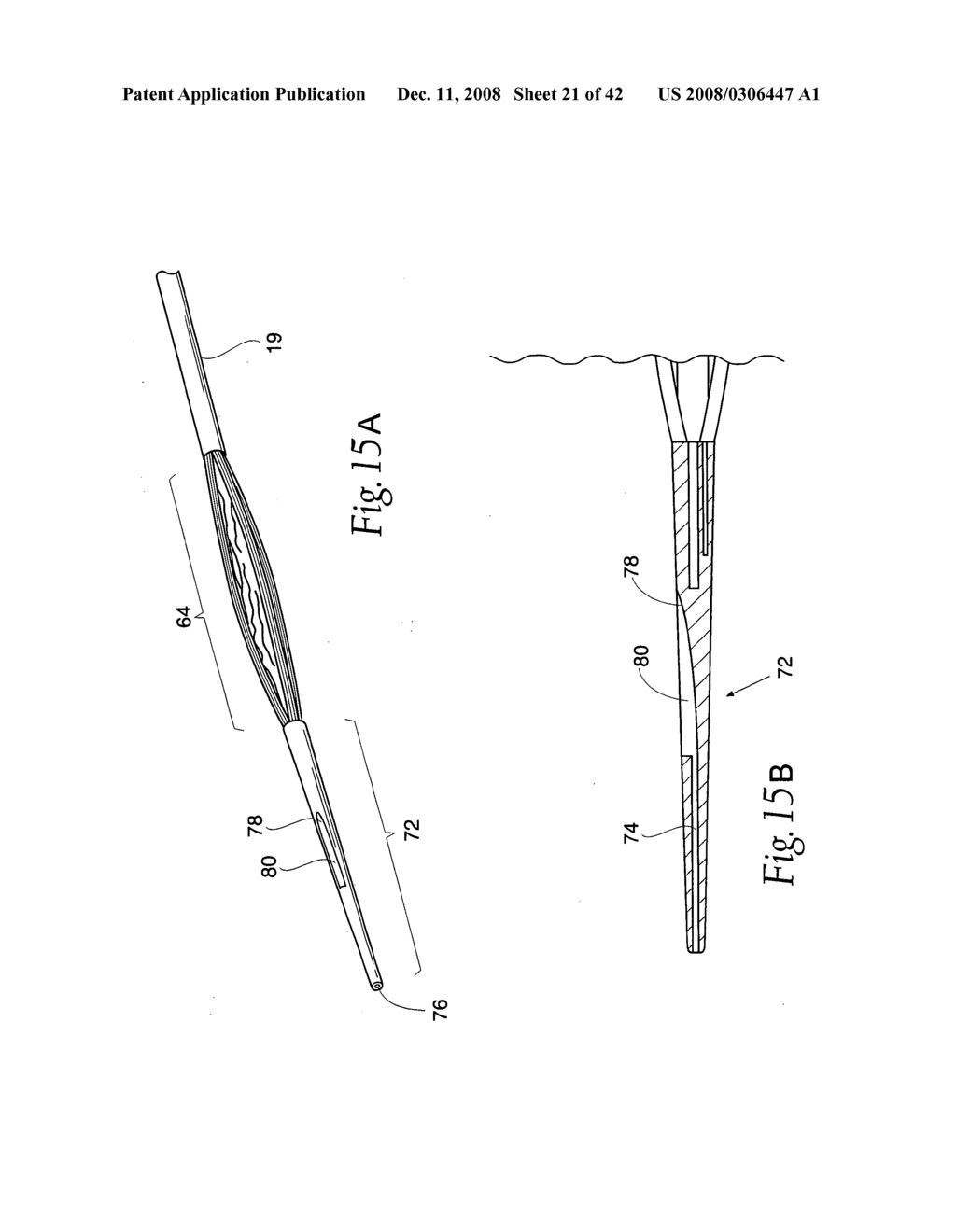 Systems and methods employing a bite block insert for positioning and stabilizing external instruments deployed within the body - diagram, schematic, and image 22