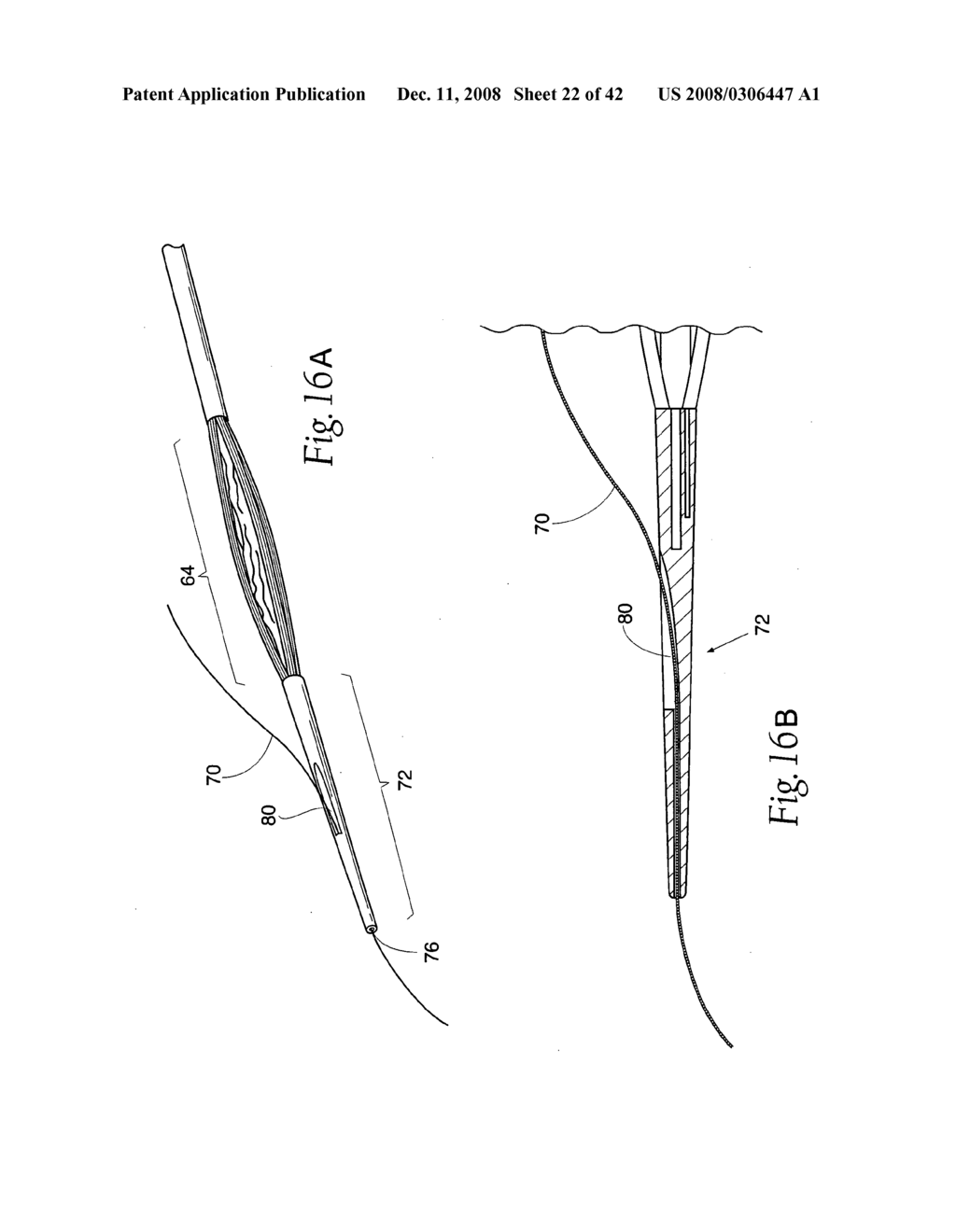 Systems and methods employing a bite block insert for positioning and stabilizing external instruments deployed within the body - diagram, schematic, and image 23