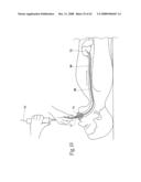 Systems and methods employing a bite block insert for positioning and stabilizing external instruments deployed within the body diagram and image