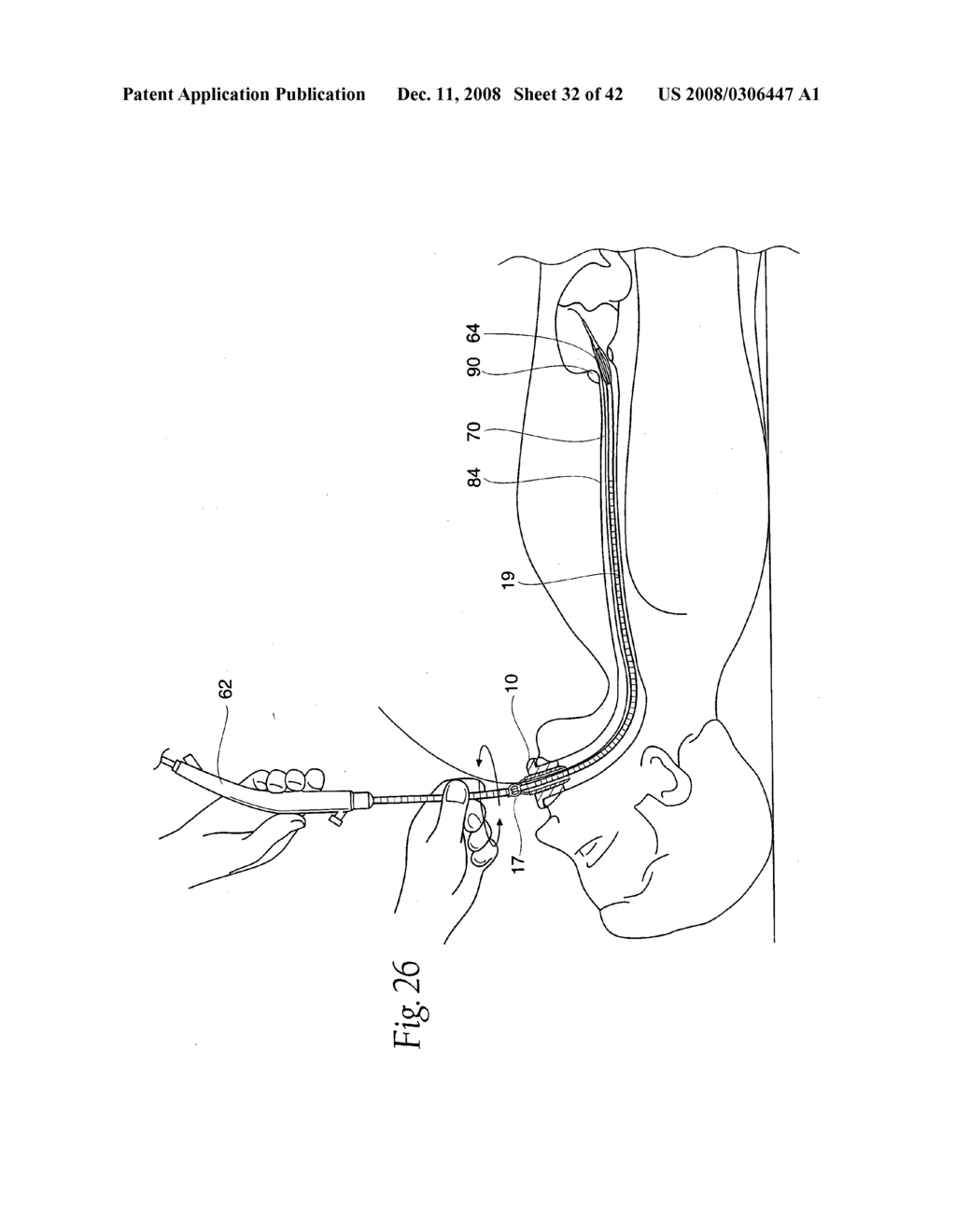 Systems and methods employing a bite block insert for positioning and stabilizing external instruments deployed within the body - diagram, schematic, and image 33