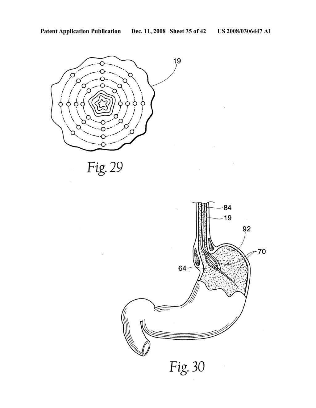 Systems and methods employing a bite block insert for positioning and stabilizing external instruments deployed within the body - diagram, schematic, and image 36