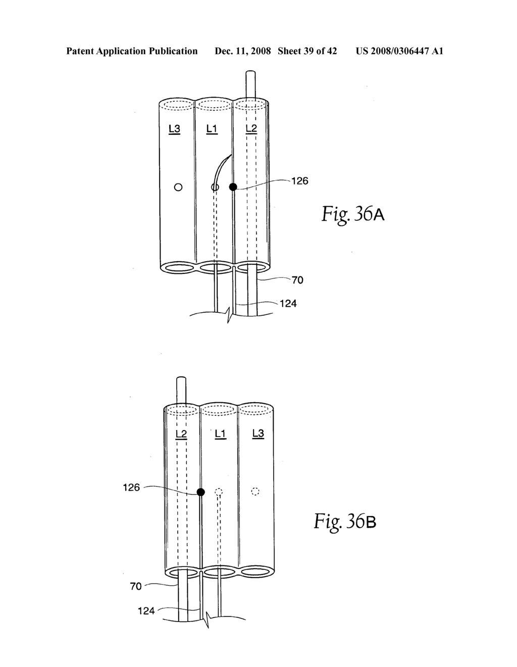 Systems and methods employing a bite block insert for positioning and stabilizing external instruments deployed within the body - diagram, schematic, and image 40