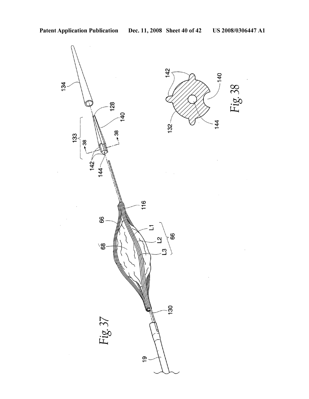 Systems and methods employing a bite block insert for positioning and stabilizing external instruments deployed within the body - diagram, schematic, and image 41