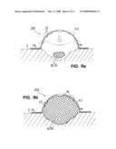 Wound Treatment Device with Elastically Deformable Vacuum-Generating Element diagram and image