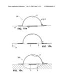 Wound Treatment Device with Elastically Deformable Vacuum-Generating Element diagram and image