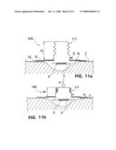 Wound Treatment Device with Elastically Deformable Vacuum-Generating Element diagram and image