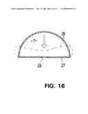 Wound Treatment Device with Elastically Deformable Vacuum-Generating Element diagram and image