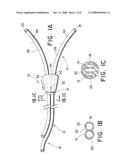 Adjustable Length Catheter diagram and image