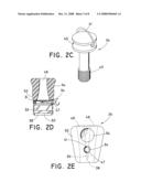 Adjustable Length Catheter diagram and image