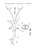 Adjustable Length Catheter diagram and image